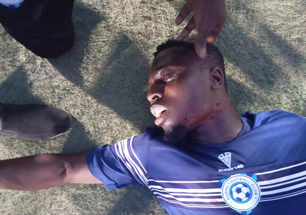 Ghanaian Footballer Narrowly Escapes Death After Attack in Nigerian Premier League Match